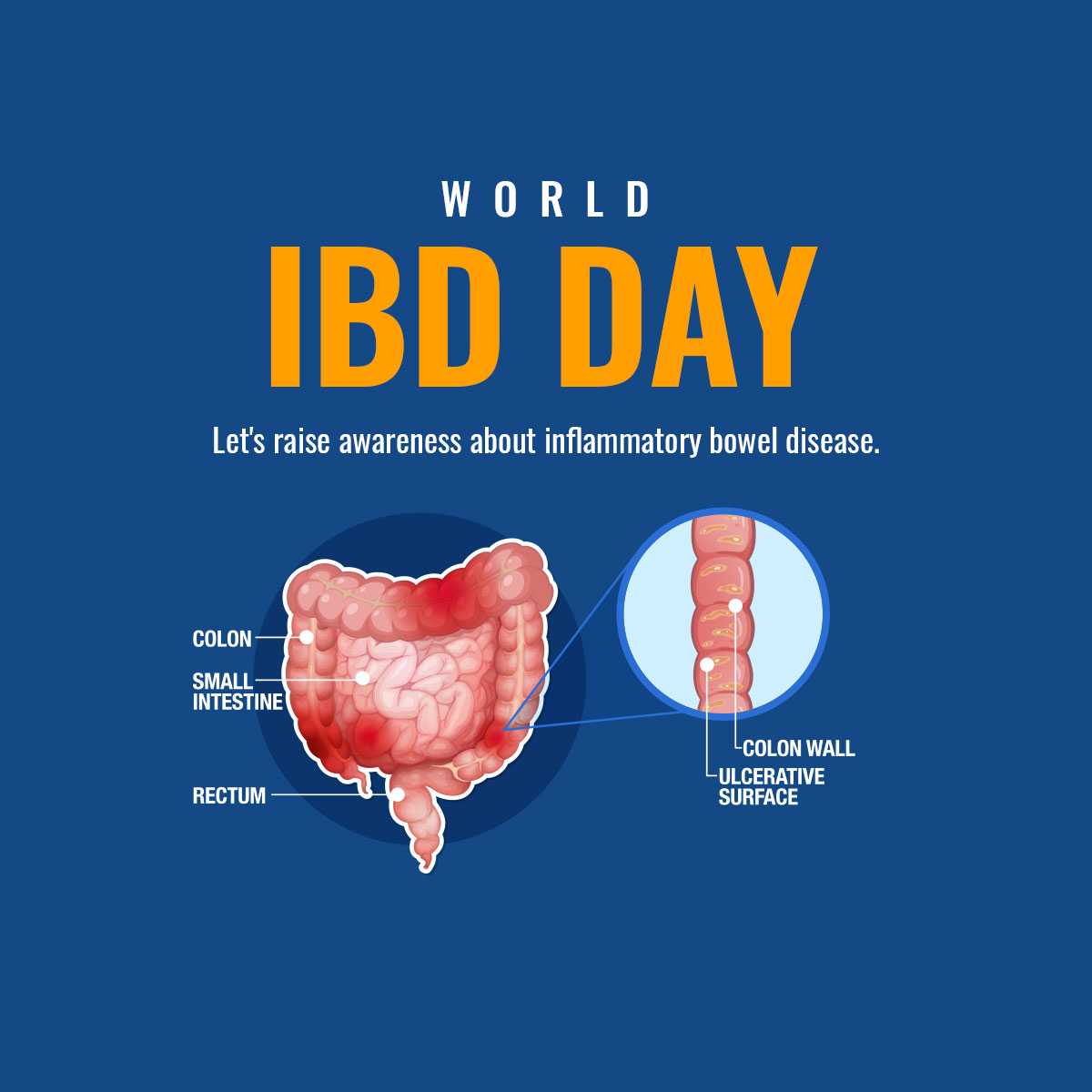 World IBD Day